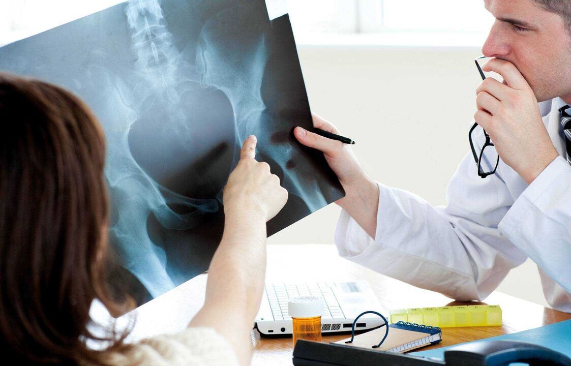 doctors examining x-rays for osteoarthritis of the hip